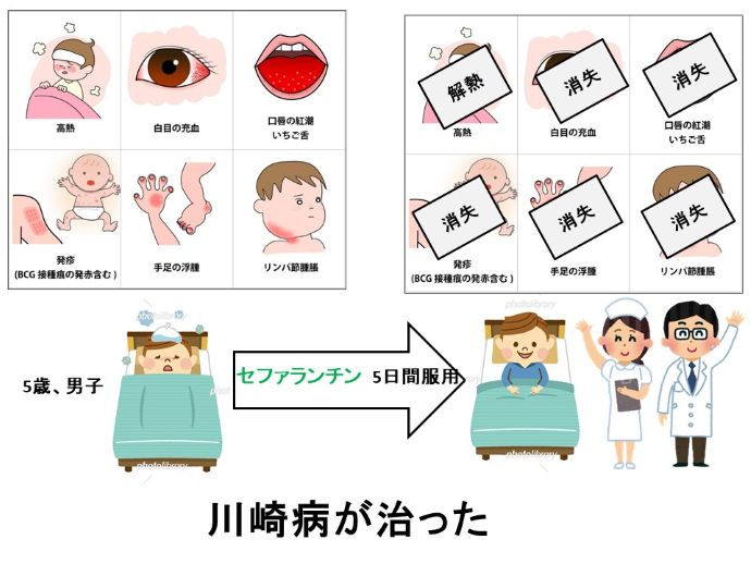 円形脱毛症　病院